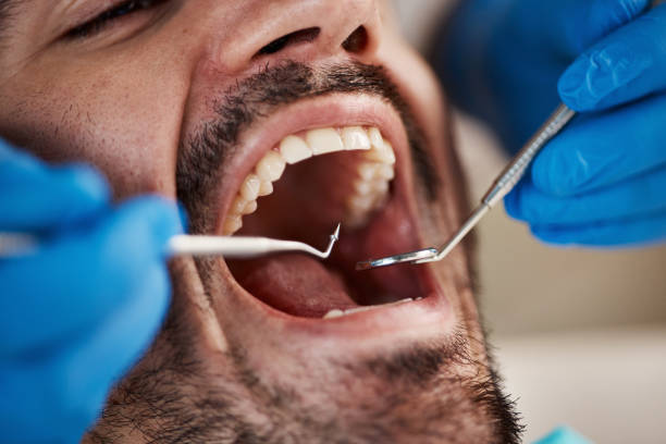 Best Cosmetic Dentistry  in Pearland, TX