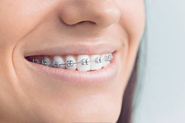 Best Veneers and Lumineers  in Pearland, TX